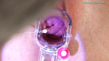 Senior Fat Gyno Doctor Looks At The Undressing Young Woman